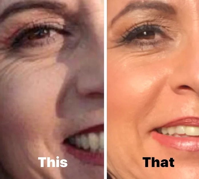 Before and after, cheek and eye
